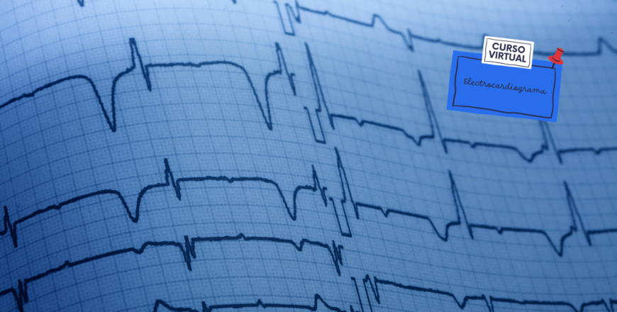 Curso de Electrocardiografia